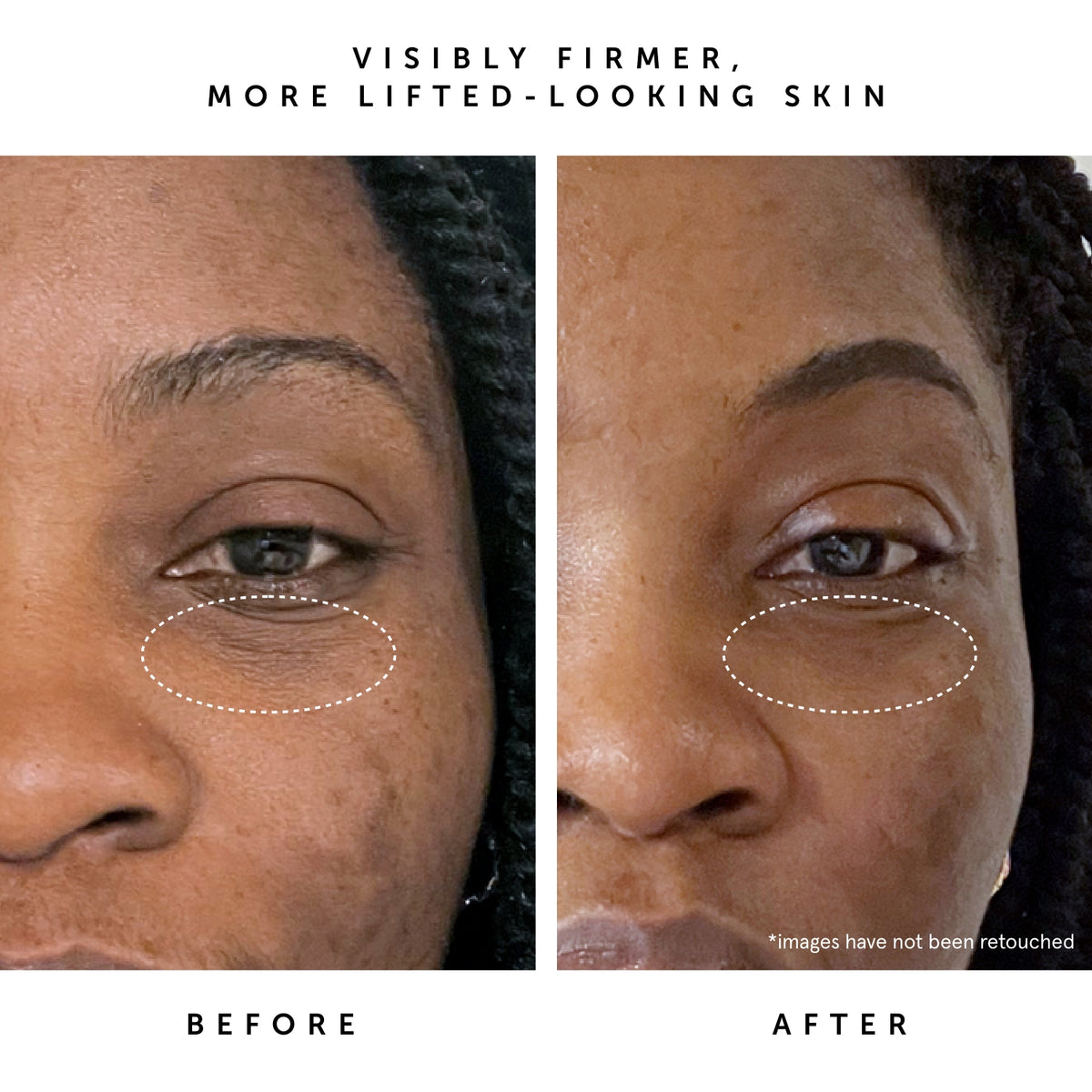 MOON FRUIT 1% Bakuchiol + Peptides Retinol Alternative Serum | Herbivore Botanicals