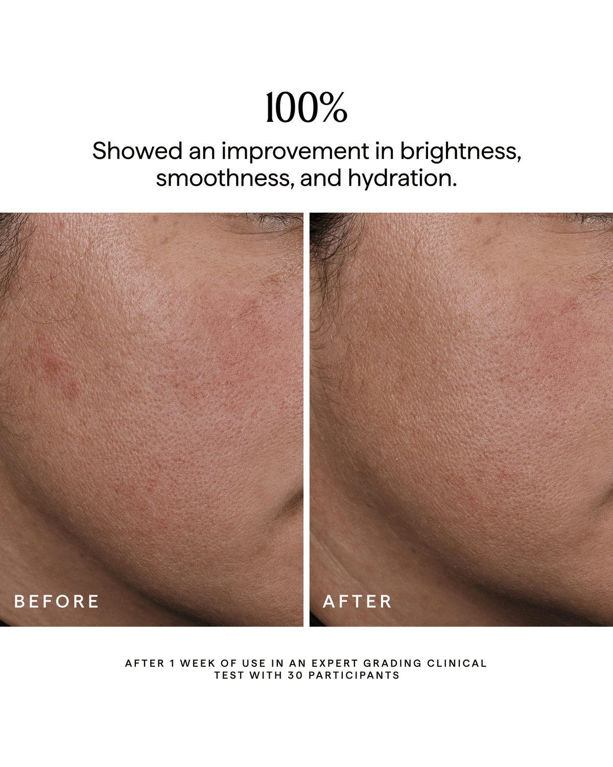 NOVA Turmeric + Niacinamide Bi-Phase Glow Facial Oil