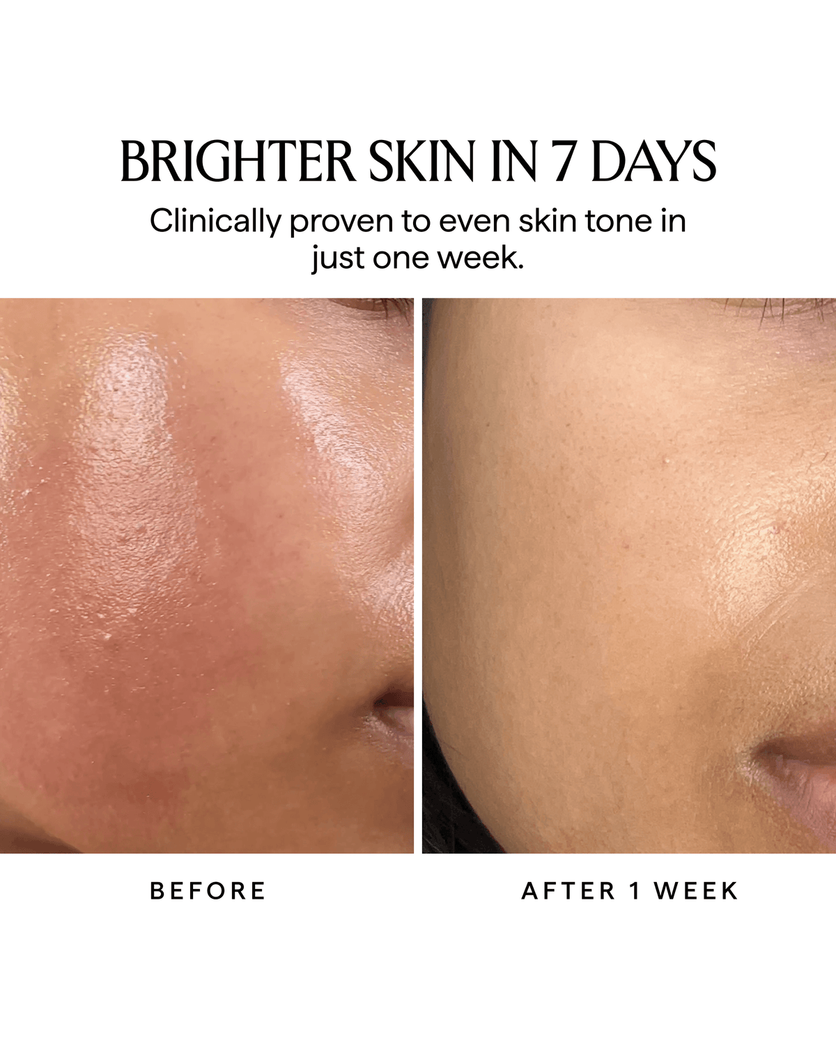 NOVA 15% Vitamin C + Turmeric Brightening Face Serum